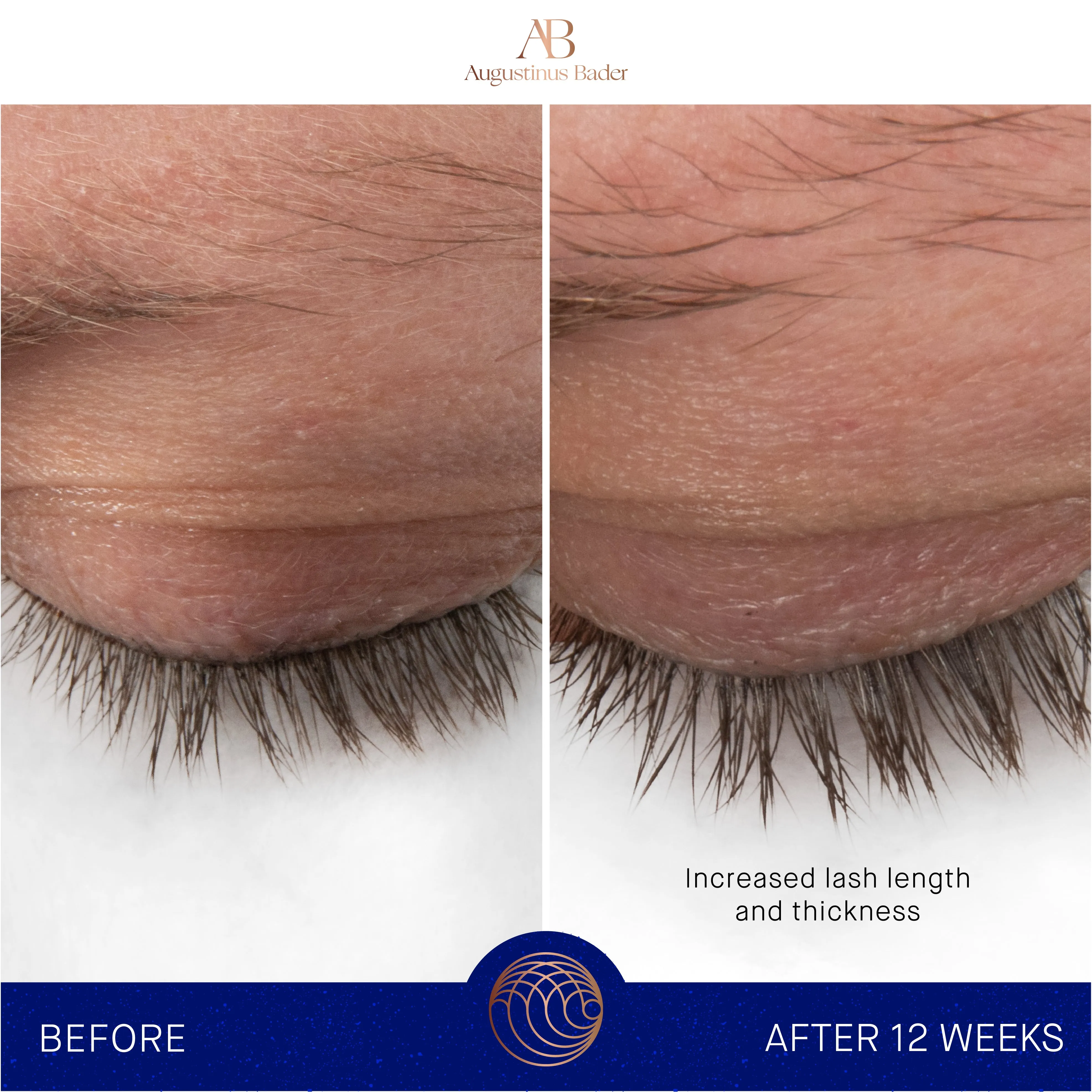 Augustinus Bader The Eyebrow & Lash Enhancing Serum