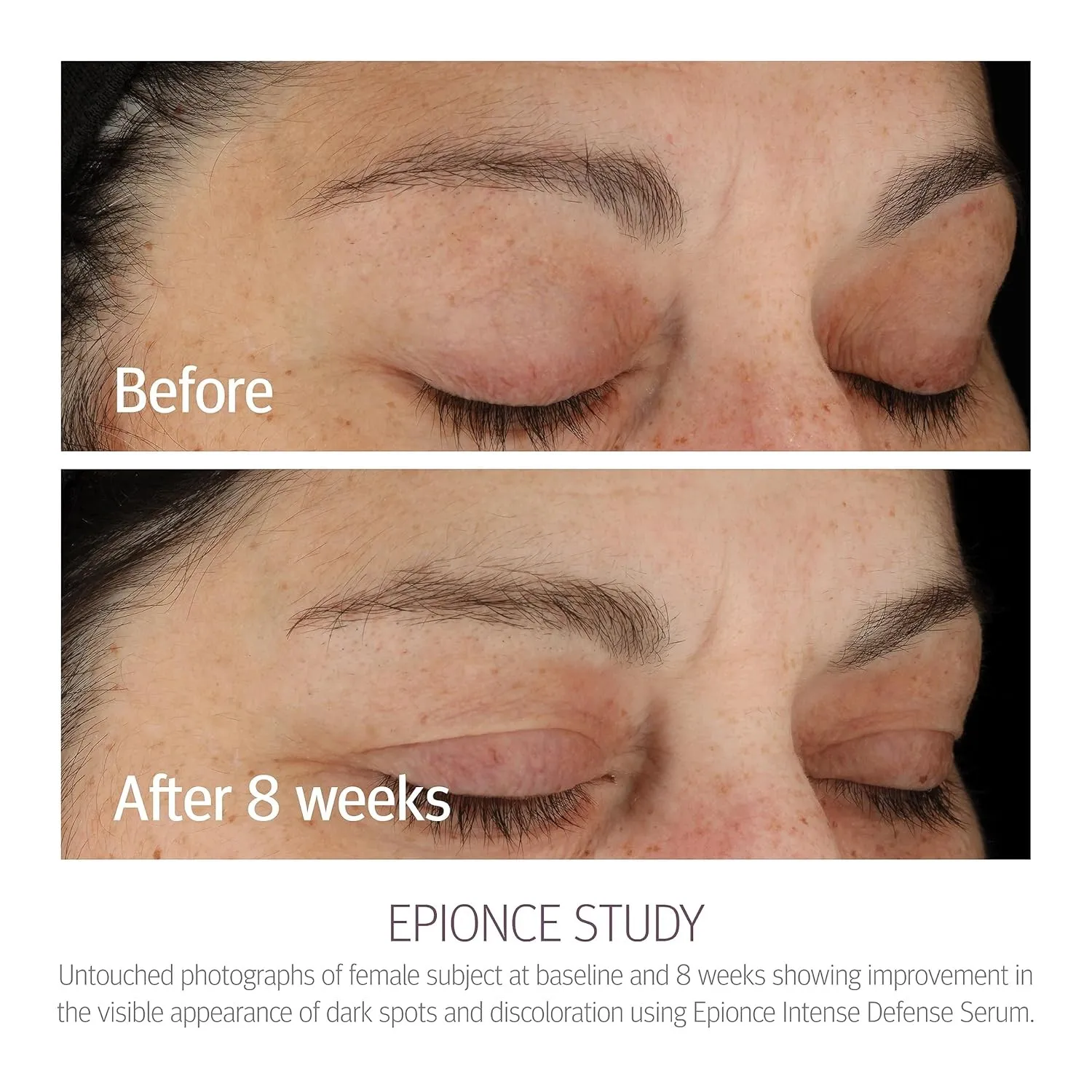 Epionce Intense Defense Serum