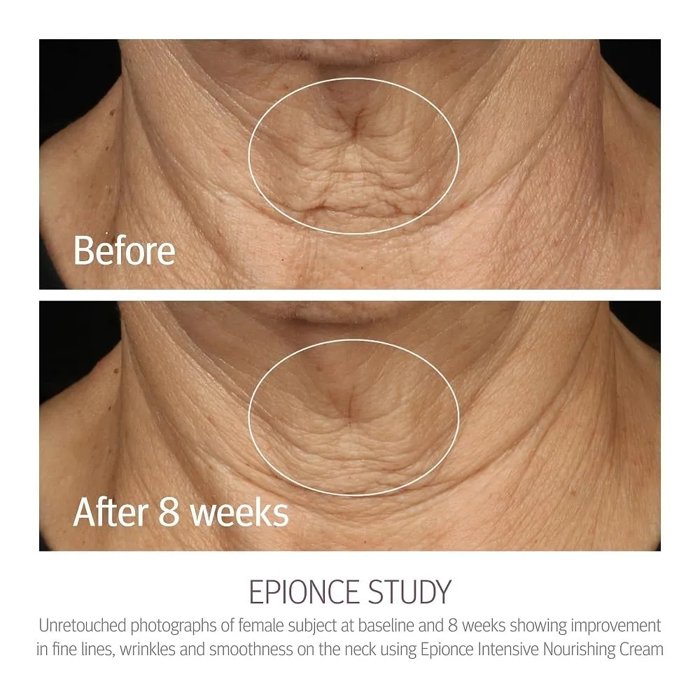Epionce Intensive Nourishing Cream