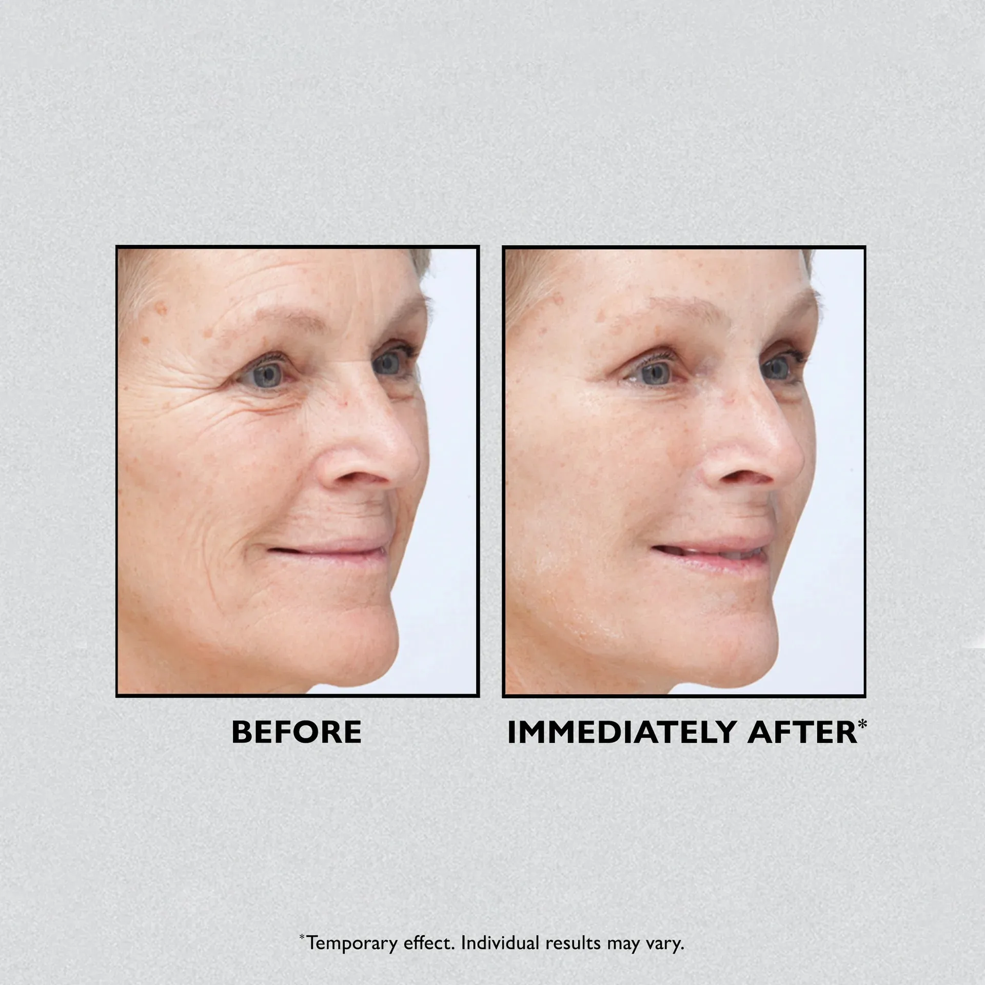 Peter Thomas Roth Instant FirmX