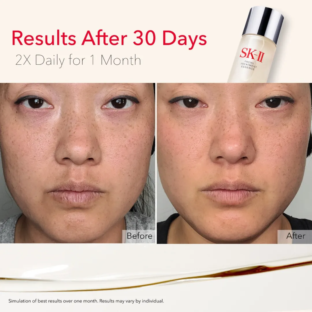 SK-II XOXO Lunar New Year Facial Treatment Essence