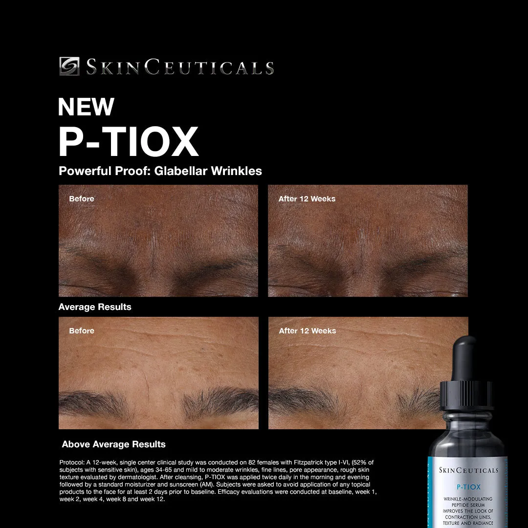 SkinCeuticals P-TIOX